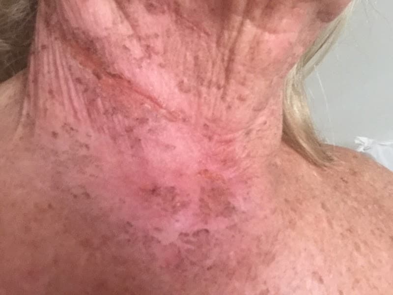 Infinity Skin Clinic Mosman — 3